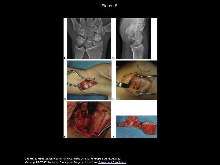 Figure 5 Journal of Hand Surgery 2015 401972 -1980 DOI: (10. 1016/j. jhsa. 2015.