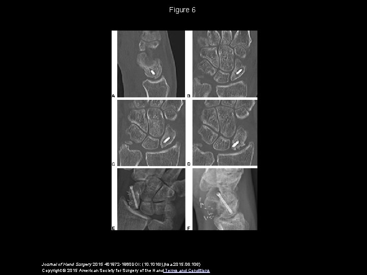 Figure 6 Journal of Hand Surgery 2015 401972 -1980 DOI: (10. 1016/j. jhsa. 2015.