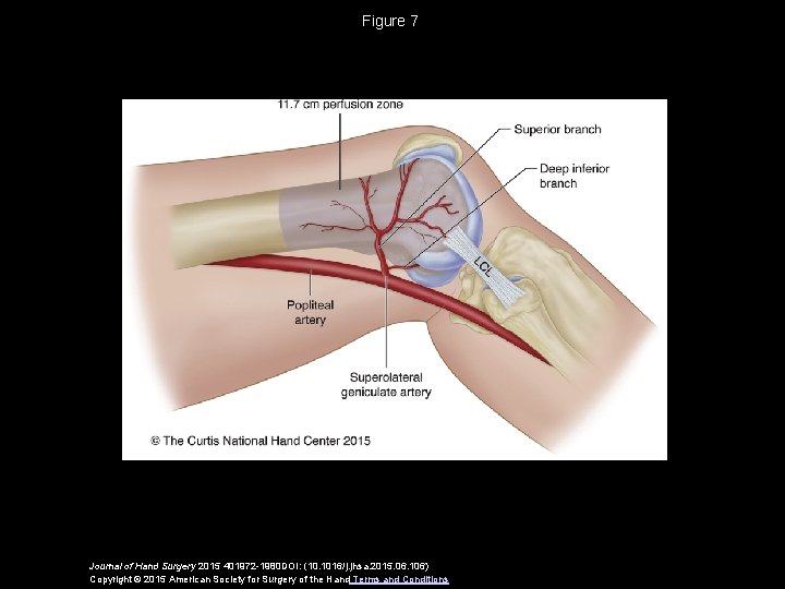 Figure 7 Journal of Hand Surgery 2015 401972 -1980 DOI: (10. 1016/j. jhsa. 2015.
