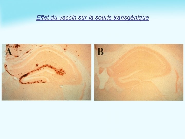 Effet du vaccin sur la souris transgénique 