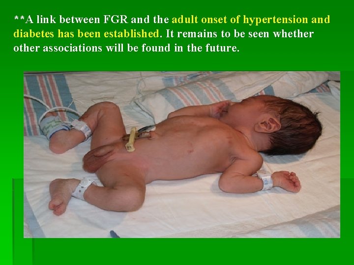 **A link between FGR and the adult onset of hypertension and diabetes has been