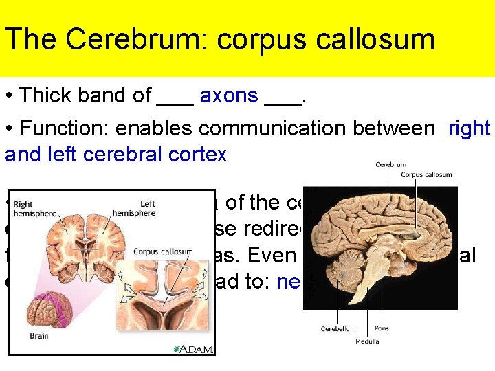 The Cerebrum: corpus callosum • Thick band of ___ axons ___. • Function: enables