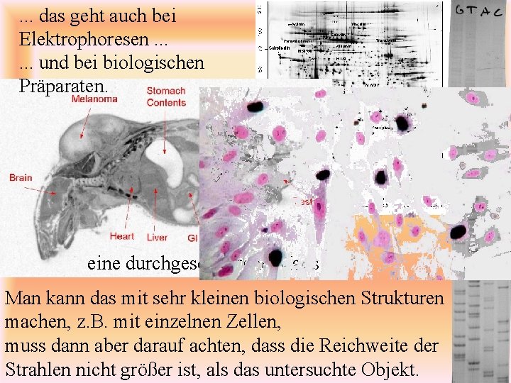 . . . das geht auch bei Elektrophoresen. . . und bei biologischen Präparaten.