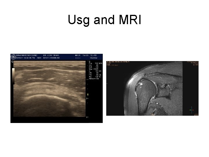 Usg and MRI 