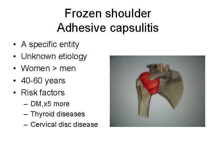 Frozen shoulder Adhesive capsulitis • • • A specific entity Unknown etiology Women >