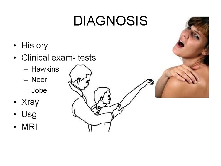 DIAGNOSIS • History • Clinical exam- tests – Hawkins – Neer – Jobe •