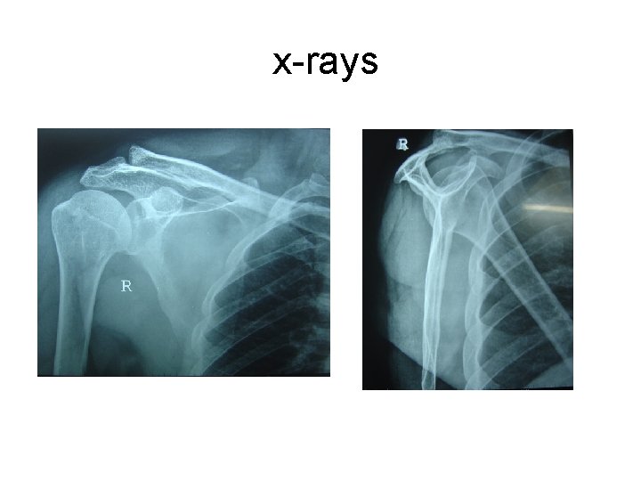 x-rays 