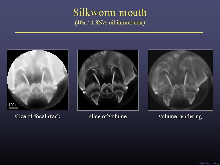 Silkworm mouth (40 x / 1. 3 NA oil immersion) 100μ slice of focal Silkworm mouth (40 x / 1. 3 NA oil immersion) 100μ slice of focal