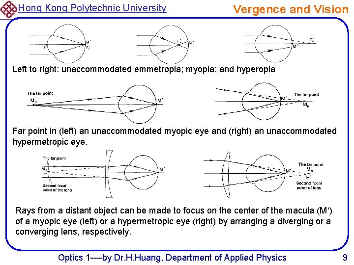 Hong Kong Polytechnic University Vergence and Vision Left to right: unaccommodated emmetropia; myopia; and