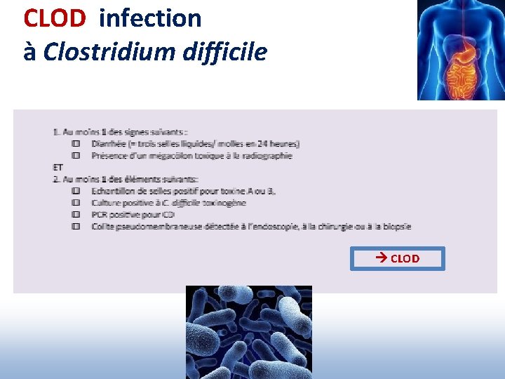 CLOD infection à Clostridium difficile CLOD 