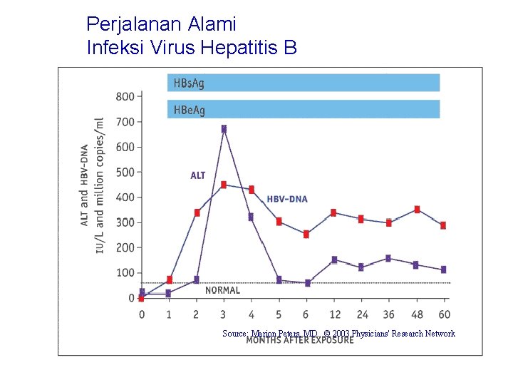 Perjalanan Alami Infeksi Virus Hepatitis B Source: Marion Peters, MD. © 2003 Physicians' Research
