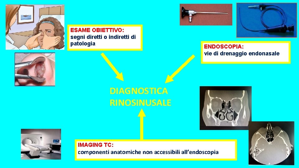 ESAME OBIETTIVO: segni diretti o indiretti di patologia ENDOSCOPIA: vie di drenaggio endonasale DIAGNOSTICA ESAME OBIETTIVO: segni diretti o indiretti di patologia ENDOSCOPIA: vie di drenaggio endonasale DIAGNOSTICA