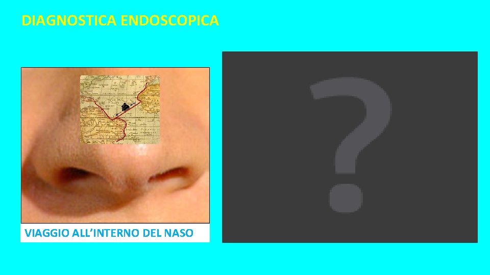 DIAGNOSTICA ENDOSCOPICA VIAGGIO ALL’INTERNO DEL NASO DIAGNOSTICA ENDOSCOPICA VIAGGIO ALL’INTERNO DEL NASO