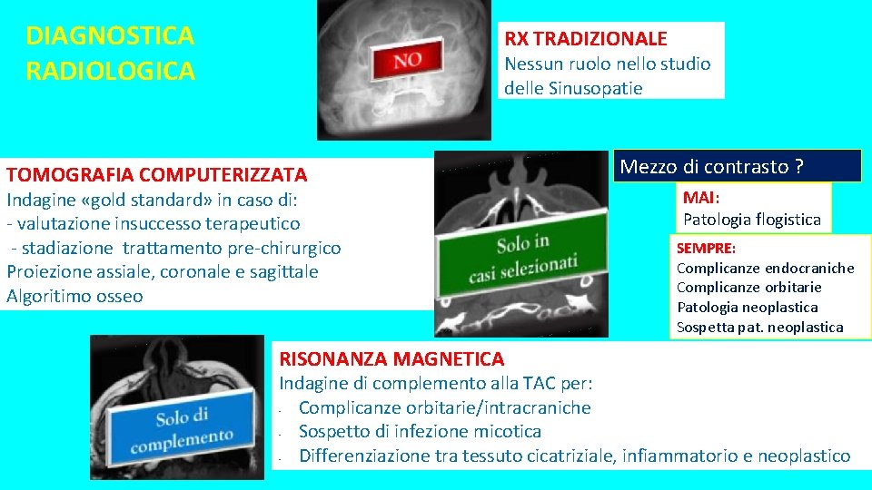 DIAGNOSTICA RADIOLOGICA RX TRADIZIONALE Nessun ruolo nello studio delle Sinusopatie TOMOGRAFIA COMPUTERIZZATA Indagine «gold DIAGNOSTICA RADIOLOGICA RX TRADIZIONALE Nessun ruolo nello studio delle Sinusopatie TOMOGRAFIA COMPUTERIZZATA Indagine «gold