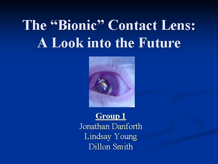 The “Bionic” Contact Lens: A Look into the Future Group 1 Jonathan Danforth Lindsay