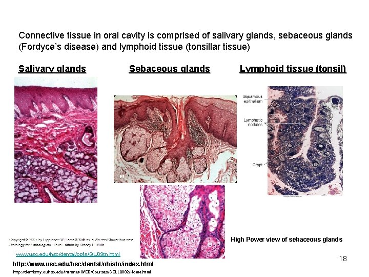 Connective tissue in oral cavity is comprised of salivary glands, sebaceous glands (Fordyce’s disease)