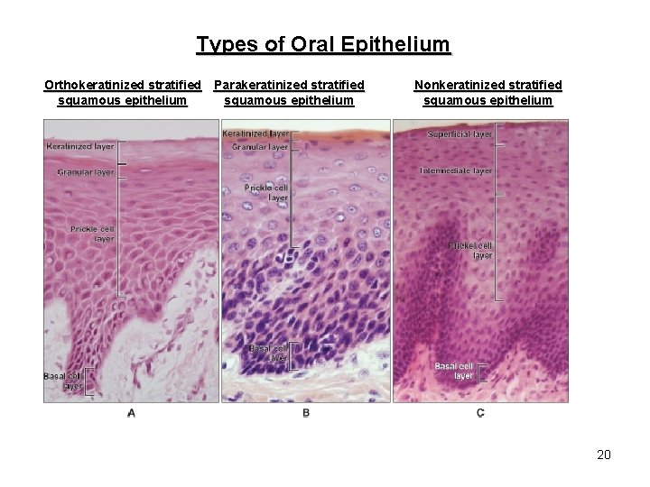 Types of Oral Epithelium Orthokeratinized stratified Parakeratinized stratified squamous epithelium Nonkeratinized stratified squamous epithelium