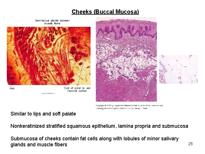 Cheeks (Buccal Mucosa) Similar to lips and soft palate Nonkeratinized stratified squamous epithelium, lamina
