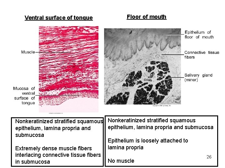 Ventral surface of tongue Floor of mouth Nonkeratinized stratified squamous epithelium, lamina propria and