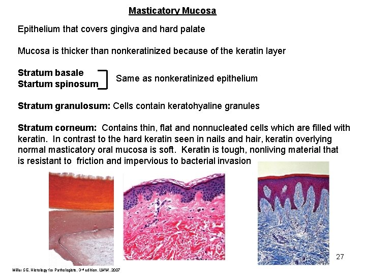 Masticatory Mucosa Epithelium that covers gingiva and hard palate Mucosa is thicker than nonkeratinized