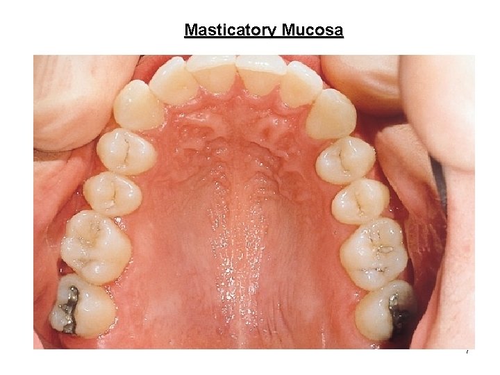 Masticatory Mucosa 7 