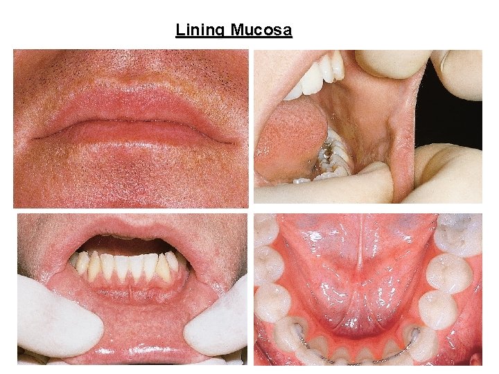 Lining Mucosa 8 