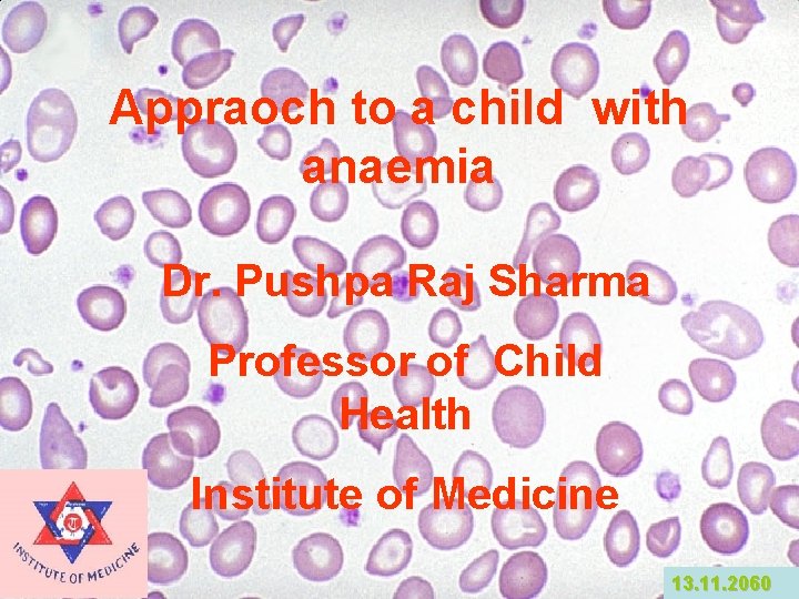 Appraoch to a child with anaemia Dr. Pushpa Raj Sharma Professor of Child Health Appraoch to a child with anaemia Dr. Pushpa Raj Sharma Professor of Child Health