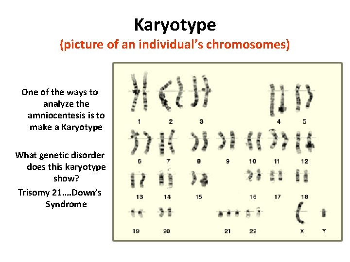 Karyotype (picture of an individual’s chromosomes) One of the ways to analyze the amniocentesis Karyotype (picture of an individual’s chromosomes) One of the ways to analyze the amniocentesis