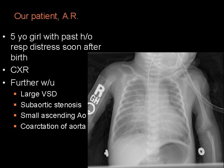 Our patient, A. R. • 5 yo girl with past h/o resp distress soon