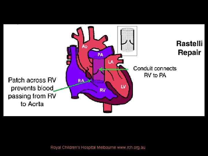 Royal Children’s Hospital Melbourne www. rch. org. au 