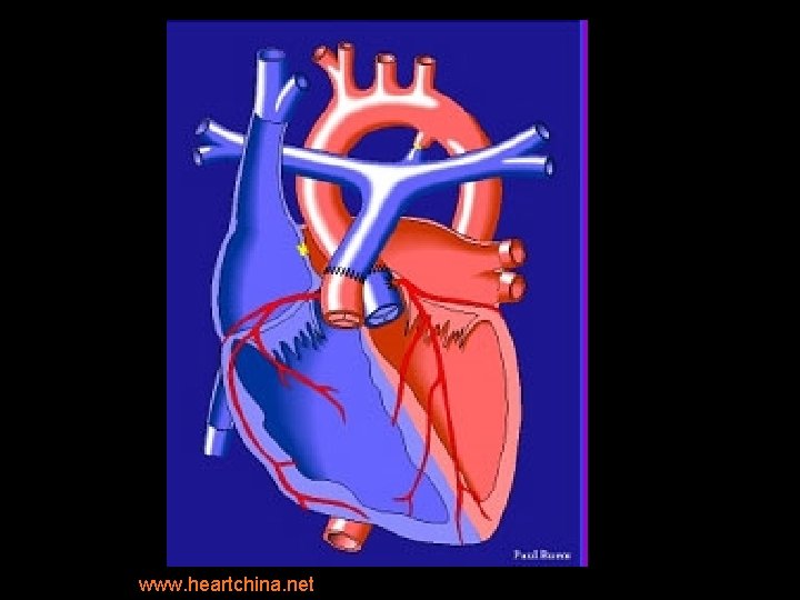 www. heartchina. net 