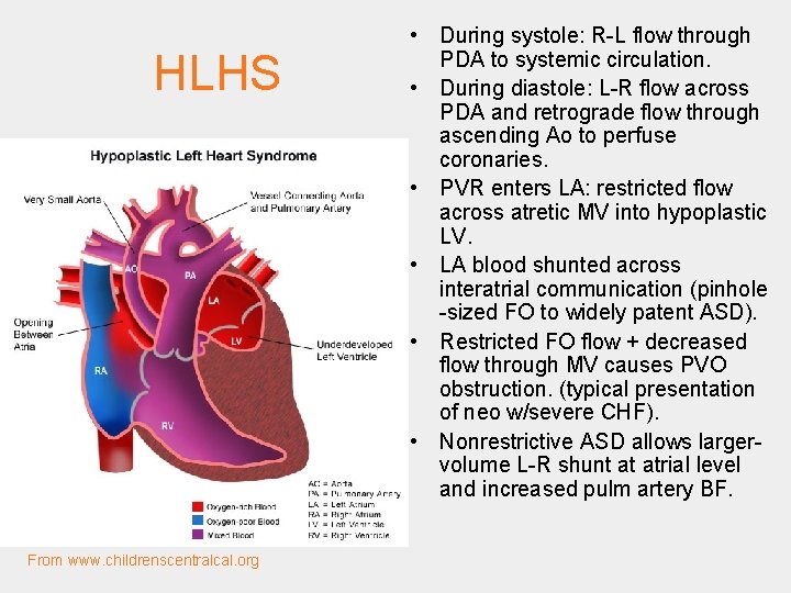 HLHS From www. childrenscentralcal. org • During systole: R-L flow through PDA to systemic