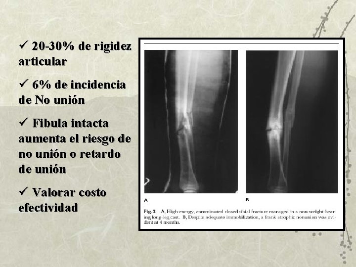 ü 20 -30% de rigidez articular ü 6% de incidencia de No unión ü