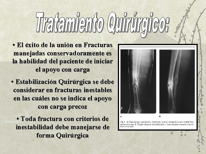  • El éxito de la unión en Fracturas manejadas conservadoramente es la habilidad