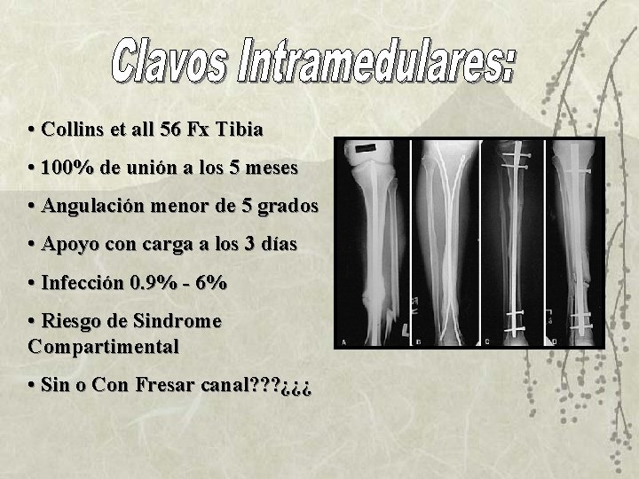 • Collins et all 56 Fx Tibia • 100% de unión a los