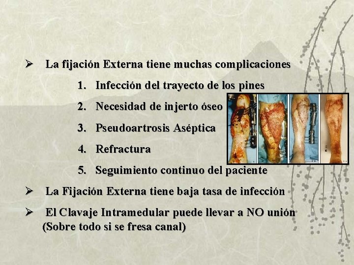 Ø La fijación Externa tiene muchas complicaciones 1. Infección del trayecto de los pines