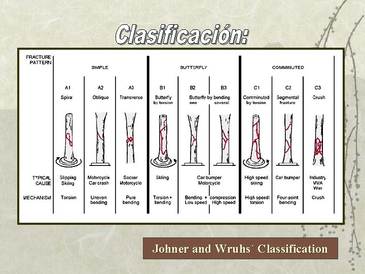 Johner and Wruhs´ Classification 