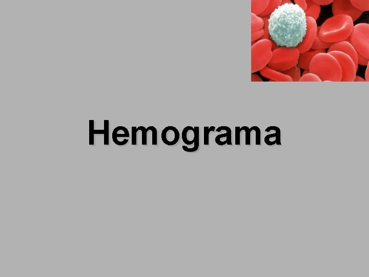 Hemograma 