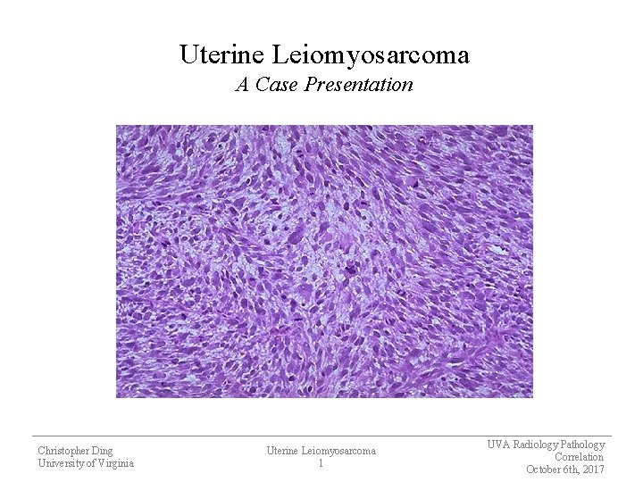 Uterine Leiomyosarcoma A Case Presentation Christopher Ding University of Virginia Uterine Leiomyosarcoma 1 UVA