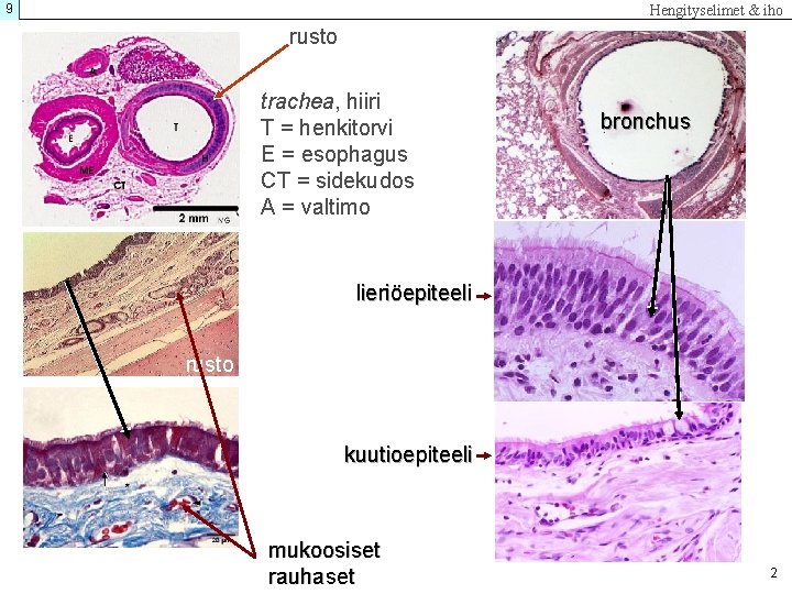 9 Hengityselimet & iho rusto trachea, hiiri T = henkitorvi E = esophagus CT