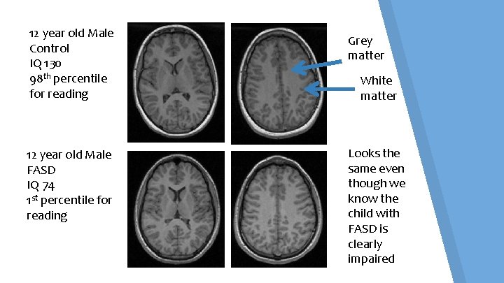 12 year old Male Control IQ 130 98 th percentile for reading 12 year 12 year old Male Control IQ 130 98 th percentile for reading 12 year