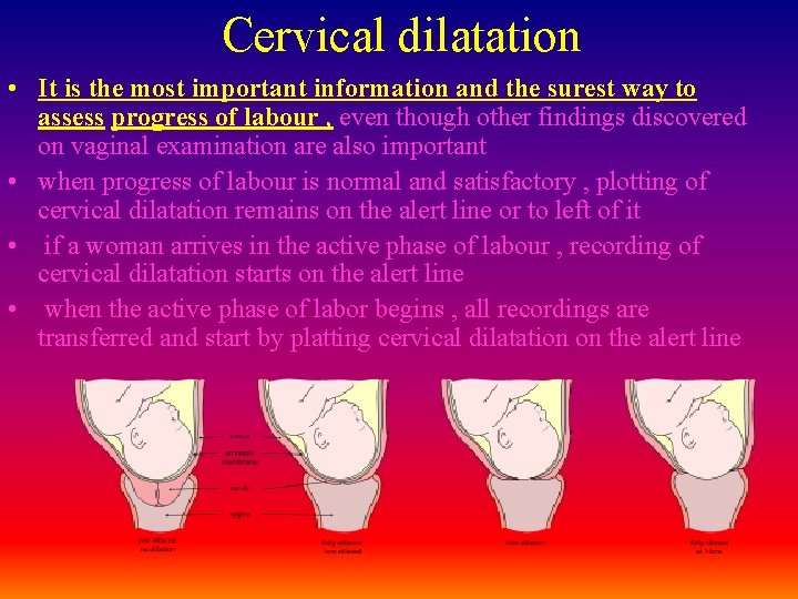 Cervical dilatation • It is the most important information and the surest way to