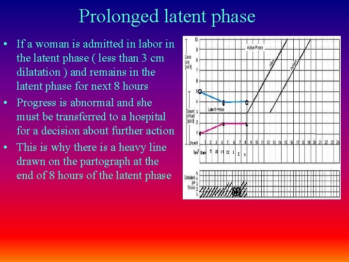 Prolonged latent phase • If a woman is admitted in labor in the latent