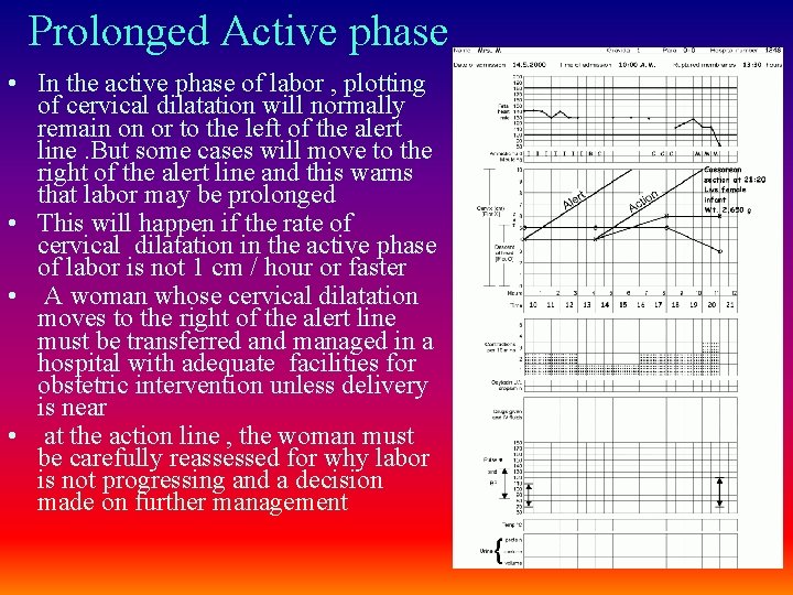 Prolonged Active phase • In the active phase of labor , plotting of cervical