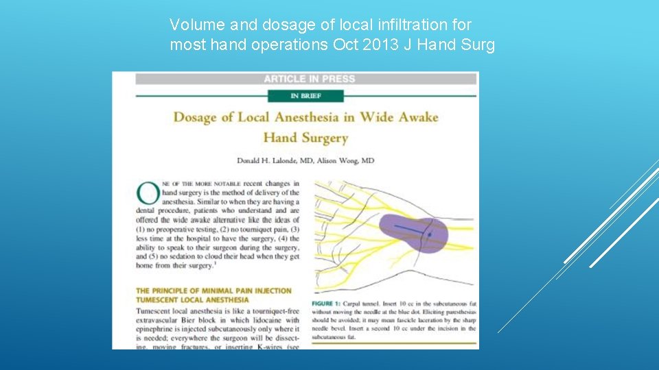 Volume and dosage of local infiltration for most hand operations Oct 2013 J Hand