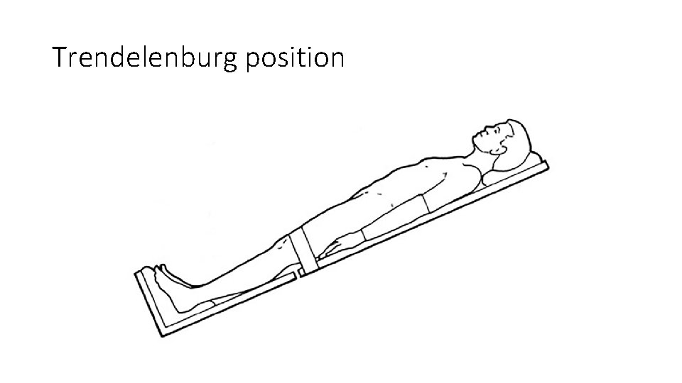 Trendelenburg position 