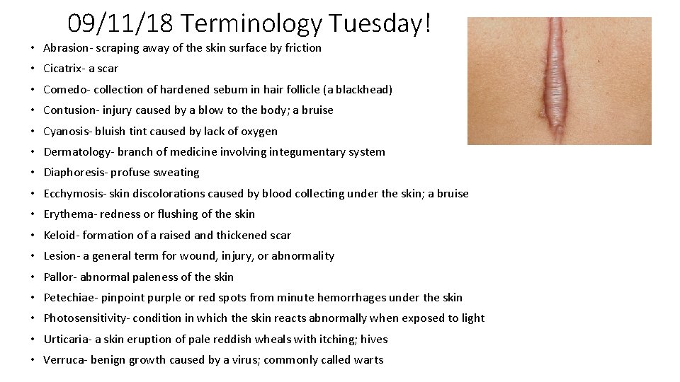 09/11/18 Terminology Tuesday! • Abrasion- scraping away of the skin surface by friction •