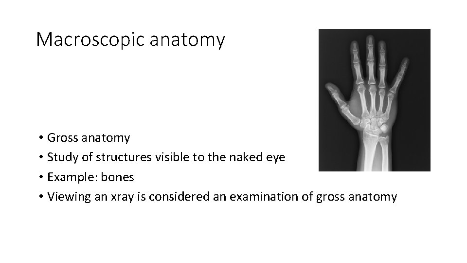 Macroscopic anatomy • Gross anatomy • Study of structures visible to the naked eye