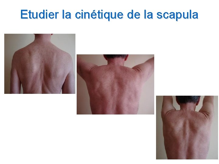 Etudier la cinétique de la scapula 