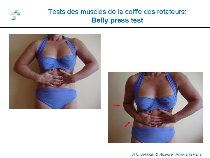 Tests des muscles de la coiffe des rotateurs: Belly press test A. N. 09/06/2012